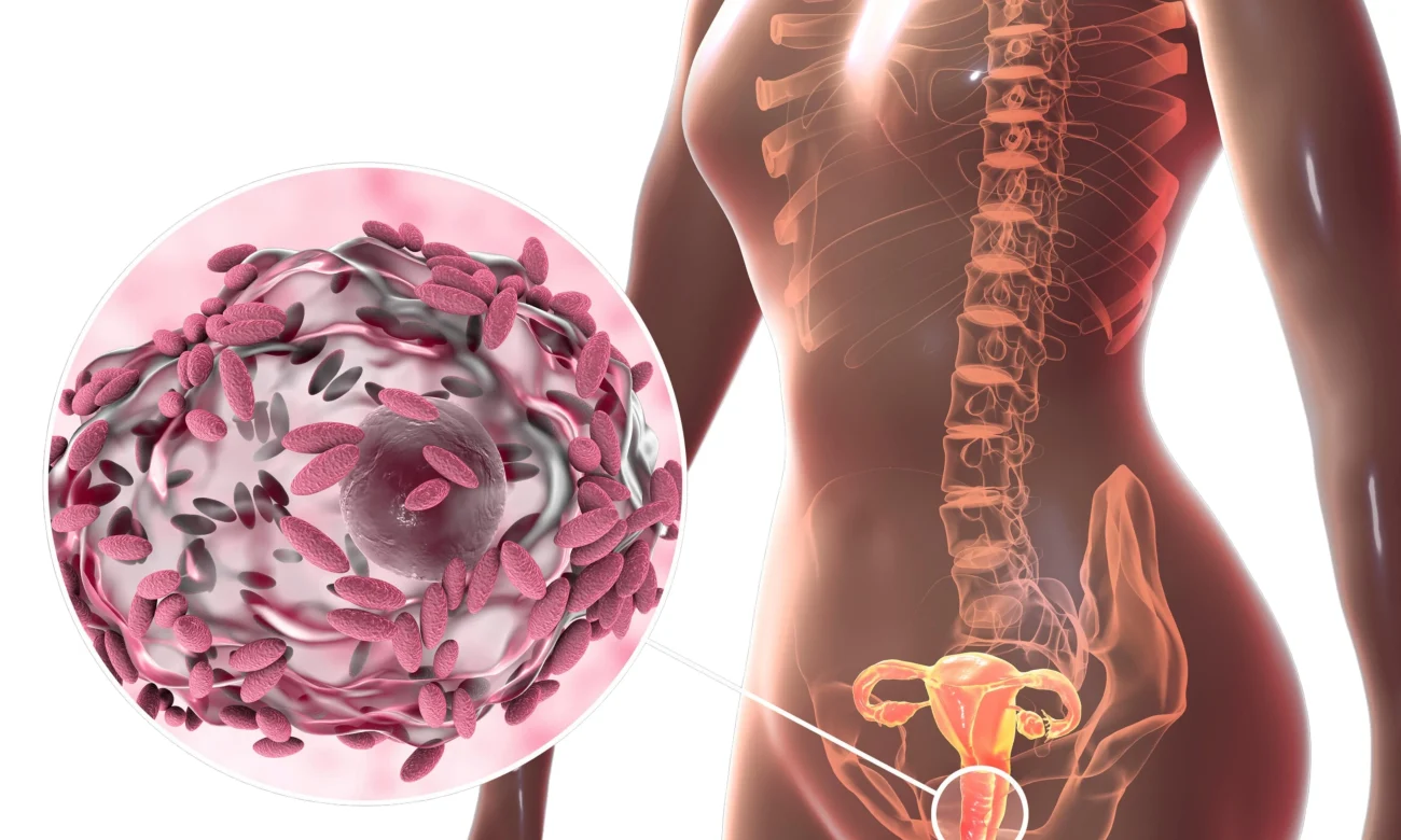 عفونت واژن داروی آنتی سپتیک واژینال