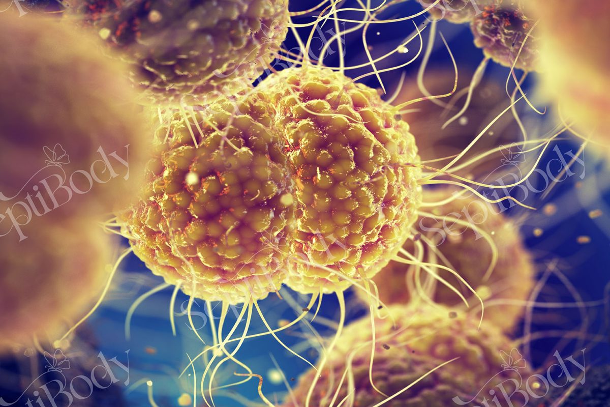 زخم دهانه رحم